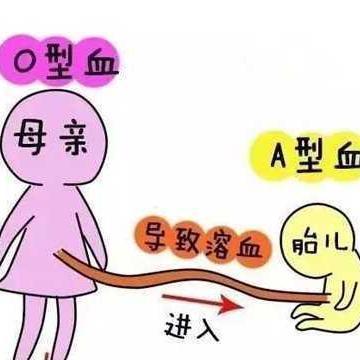 abo溶血孩子长大有影响吗